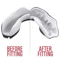 SAFEJAWZ Ochraniacz na Zęby Extro Series FANGZ dla Dzieci (wiek 9-11)